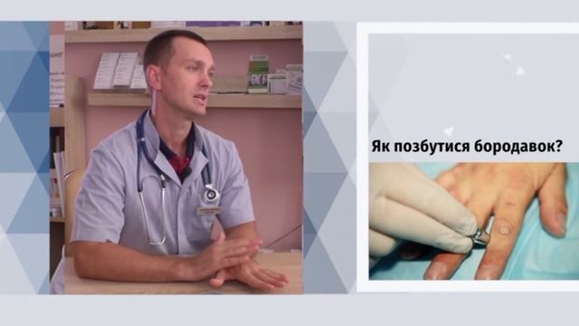 Бородавки: причини появи та як їх позбавитися смотреть онлайн