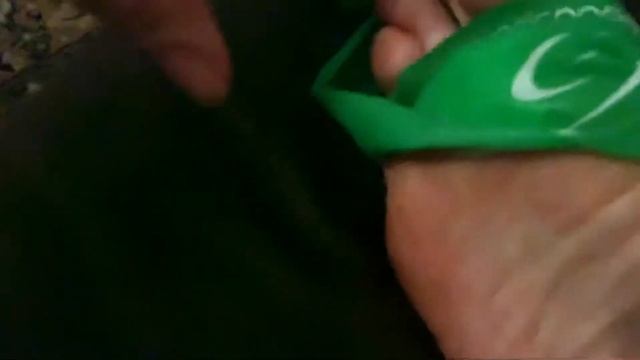 ВЫВЕДЕНИЕ ПОДОШВЕННОЙ БОРОДАВКИ УКСУСОМ. ЭКСПЕРИМЕНТ. смотреть онлайн