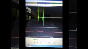 Тойота Ипсум , спотыкается, троит, не едет !!!