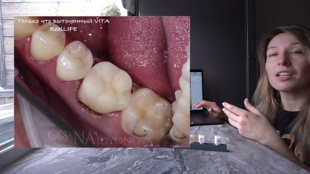 Блоки ВИТА - VITA BLOCKS смотреть онлайн