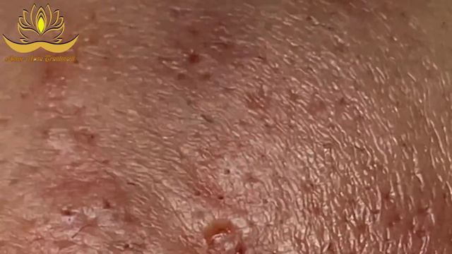 Most Satisfying and Relaxation with An Spa Video #192 смотреть онлайн