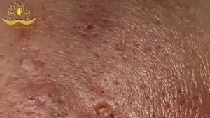 Most Satisfying and Relaxation with An Spa Video #192