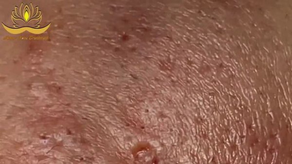 Most Satisfying and Relaxation with An Spa Video #192