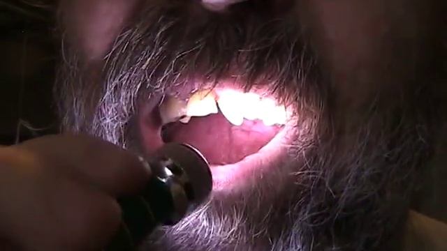 Заточить зуб? Не проблема! смотреть онлайн