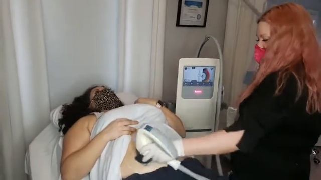 VelaShape III LIVE Treatment | Sparkle MediSpa Moncton NB смотреть онлайн