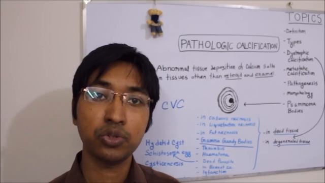 Pathologic Calcification : Definition, Types, Pathogenesis & Morphology (HD) смотреть онлайн