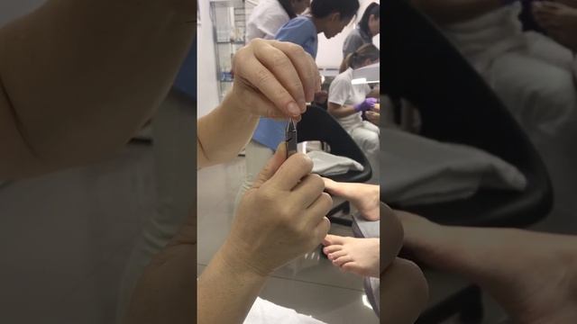 Формирование титановой нити - Подолог