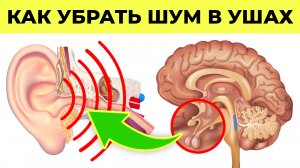 Что делать, если ЗАКЛАДЫВАЕТ УХО? / Упражнения, которые устранят шум в ушах НАВСЕГДА!