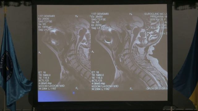 Ендоскопія в диференціальній діагностиці дисфагій смотреть онлайн