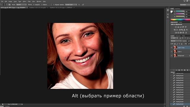 Быстрый способ убрать дефекты кожи и отбелить зубы смотреть онлайн