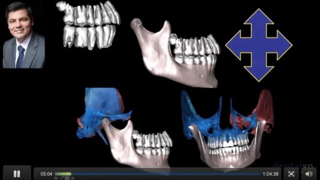 Биомеханика ВНЧС