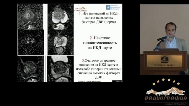 Нарек Матинян. Мультипараметрическая МРТ предстательной железы. смотреть онлайн