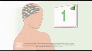 Пластыри Никоретте: Сделай то, чем будешь гордиться 2013