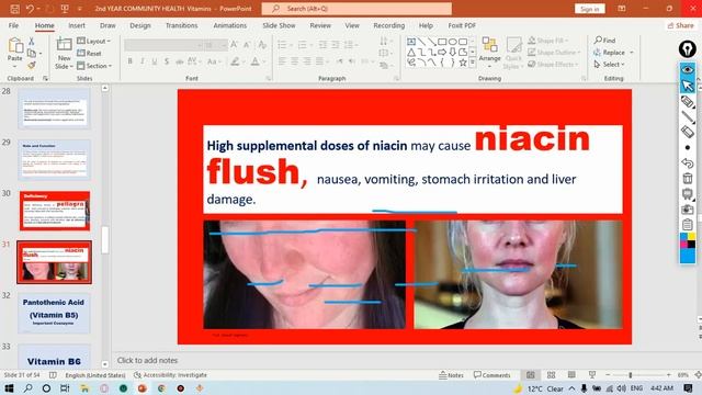 GIT | Community, Lecture (2) -Vitamins and Minerals - Wateen 2022 смотреть онлайн