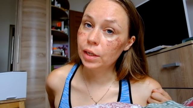 фотоомоложение лица до и после. Отзыв. Лазерная шлифовка - и о ней смотреть онлайн