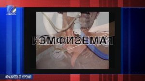 Школьникам рассказали о вреде курения