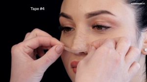 How to stick strips after rhinoplasty. Nose Tape After Rhinoplasty / KAMINSKYI