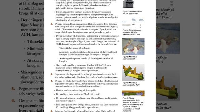 MAM25 - Introduktion til Eksamensopgave 3 - CMF Operation смотреть онлайн