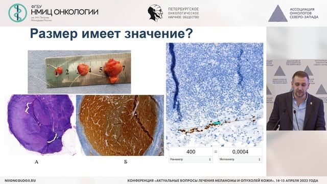 Конференция «Актуальные вопросы лечения меланомы и опухолей кожи»