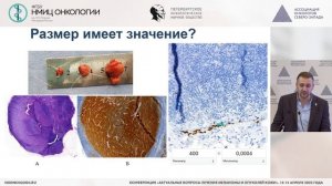 Место хирурга в лечении меланомы кожи