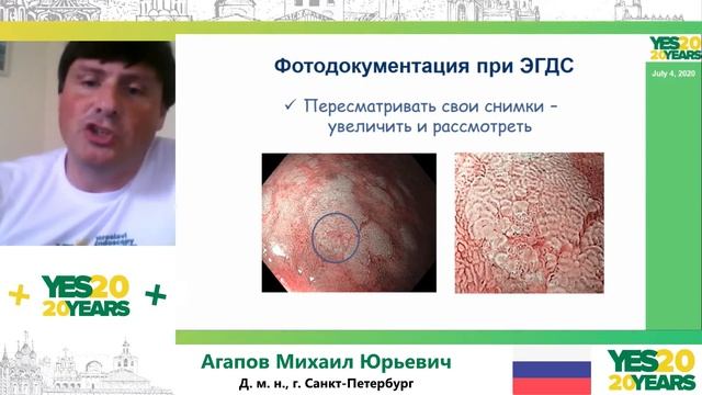 52. Стандарты выполнения ЭГДС. М. Ю. Агапов, З. В. Галкова смотреть онлайн