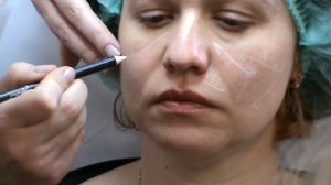 Princess, канюли, обучение, практика участника, 111013, ч5