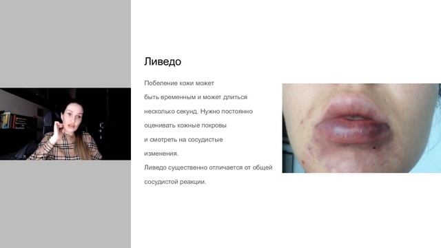 Контурная пластика губ 2 день — бесплатный мастер-класс. Яна Ащина.