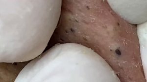 Enjoy Your Day With Hien Nguyen Spa # 1160