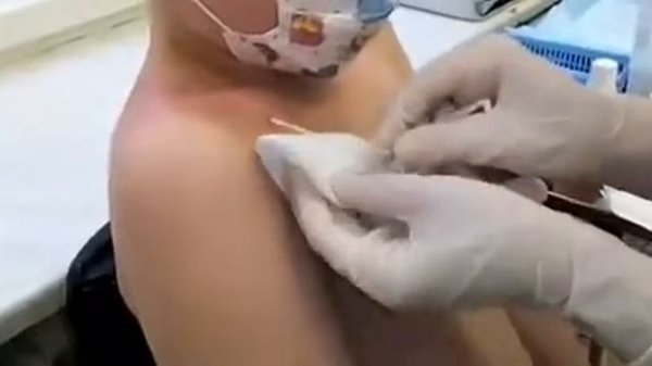 Снимают катетер