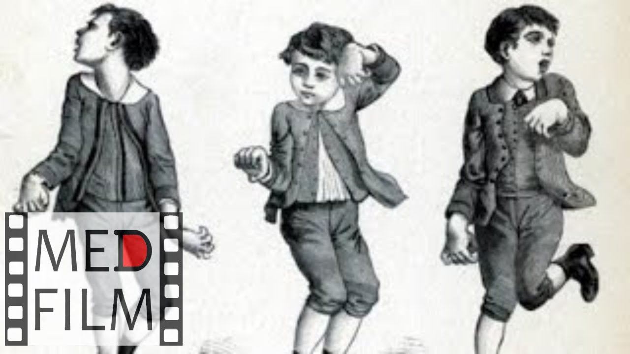 Синдром Туретта. Нервный тик. Гиперкинезы © Tourette syndrome, nervous tic