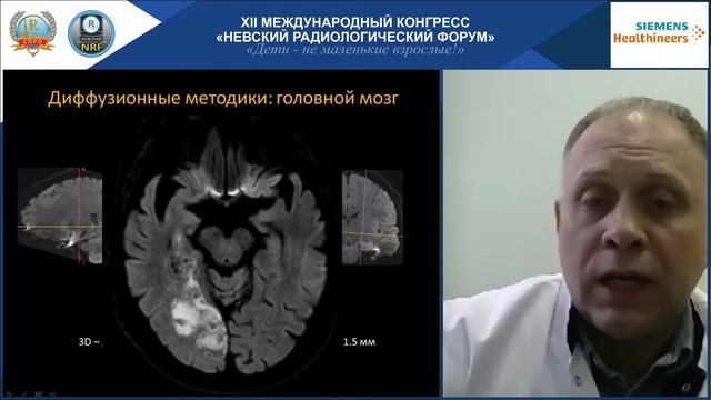 САТЕЛЛИТНЫЙ СИМПОЗИУМ КОМПАНИИ SIEMENS Healthineers смотреть онлайн