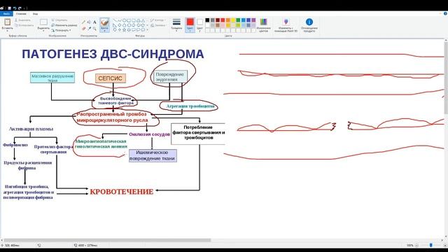 ДВС синдром на примере сепсиса смотреть онлайн