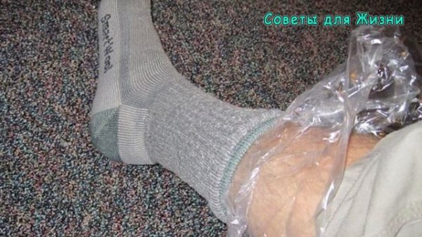 ПЯТОЧНАЯ ШПОРА – Быстрое и Простое Лечение Пяточной Шпоры Народными Средствами