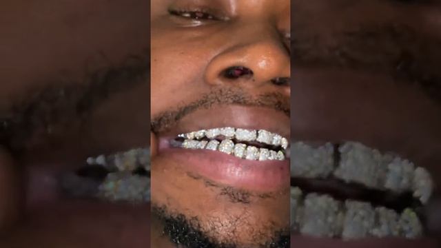 ?? Custom VVS Diamond Grill By Stacks Customs