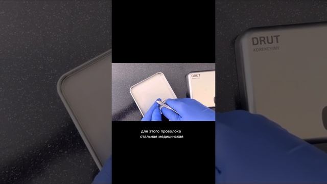Вросший ноготь у подростка смотреть онлайн