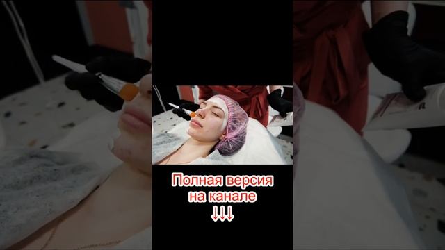 Чистка лица #shorts 5 смотреть онлайн