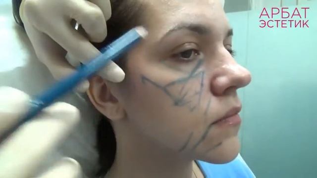 Основы процедур. Контурная пластика лица