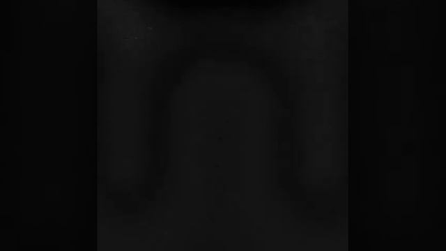 Soma Lyra 8 + Deluxe Memory Man смотреть онлайн