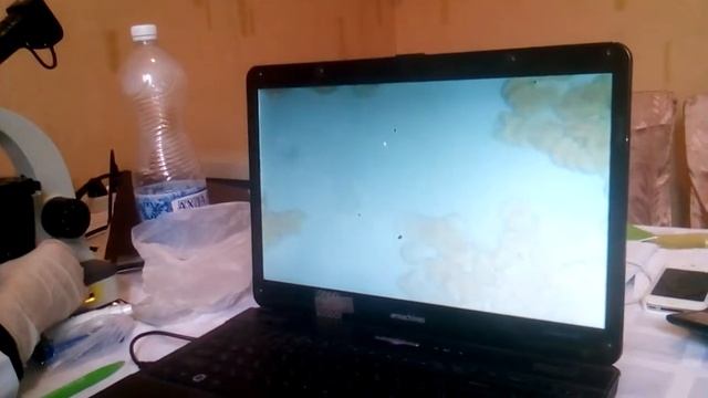 Диагностика по капле крови смотреть онлайн