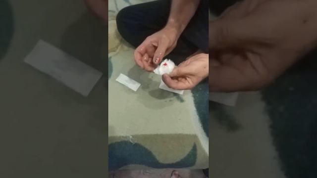 Вырывание травмированного ногтя 😷😳😫 смотреть онлайн