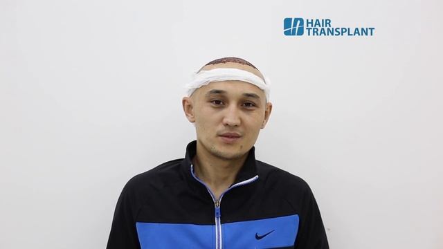 Победитель конкурса от клиники Hair Transplant смотреть онлайн