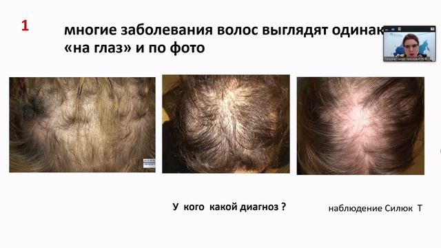 Применение FotoFinder в работе трихологов