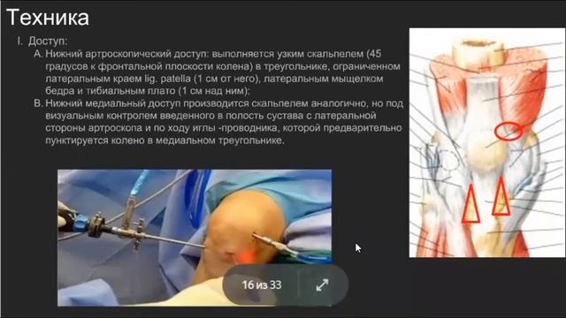 Заседание секции Травматология смотреть онлайн