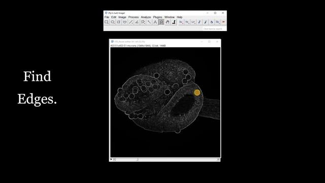 FIJI (ImageJ): Finding & Measuring Round Objects or Circles [Hough Circle Transform] смотреть онлайн