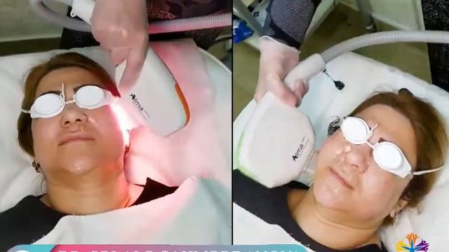 #Фотоомоложение, лечение #пигментации и розацеа смотреть онлайн