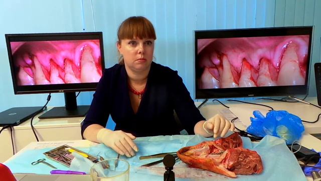 Лечение рецессий десны Носова Мария 10.11.17 Эпизод 23