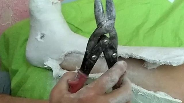 А вам приходилось СНИМАТЬ ГИПС? САМИМ смотреть онлайн
