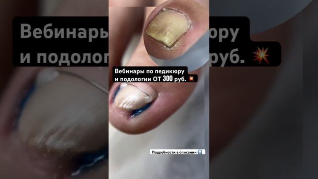 Готова к сезону педикюра? Умеешь работать со сложными ногтями? За ответом иди в описание☝🏼☝🏼 смотреть онлайн