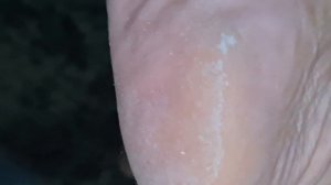 mature sole barefoot