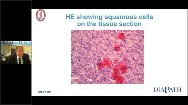 Rrecognising artefacts in staining demonstrations. Identifying a multifactorial problem. смотреть онлайн